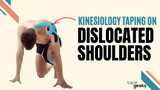 Dislocated Shoulder