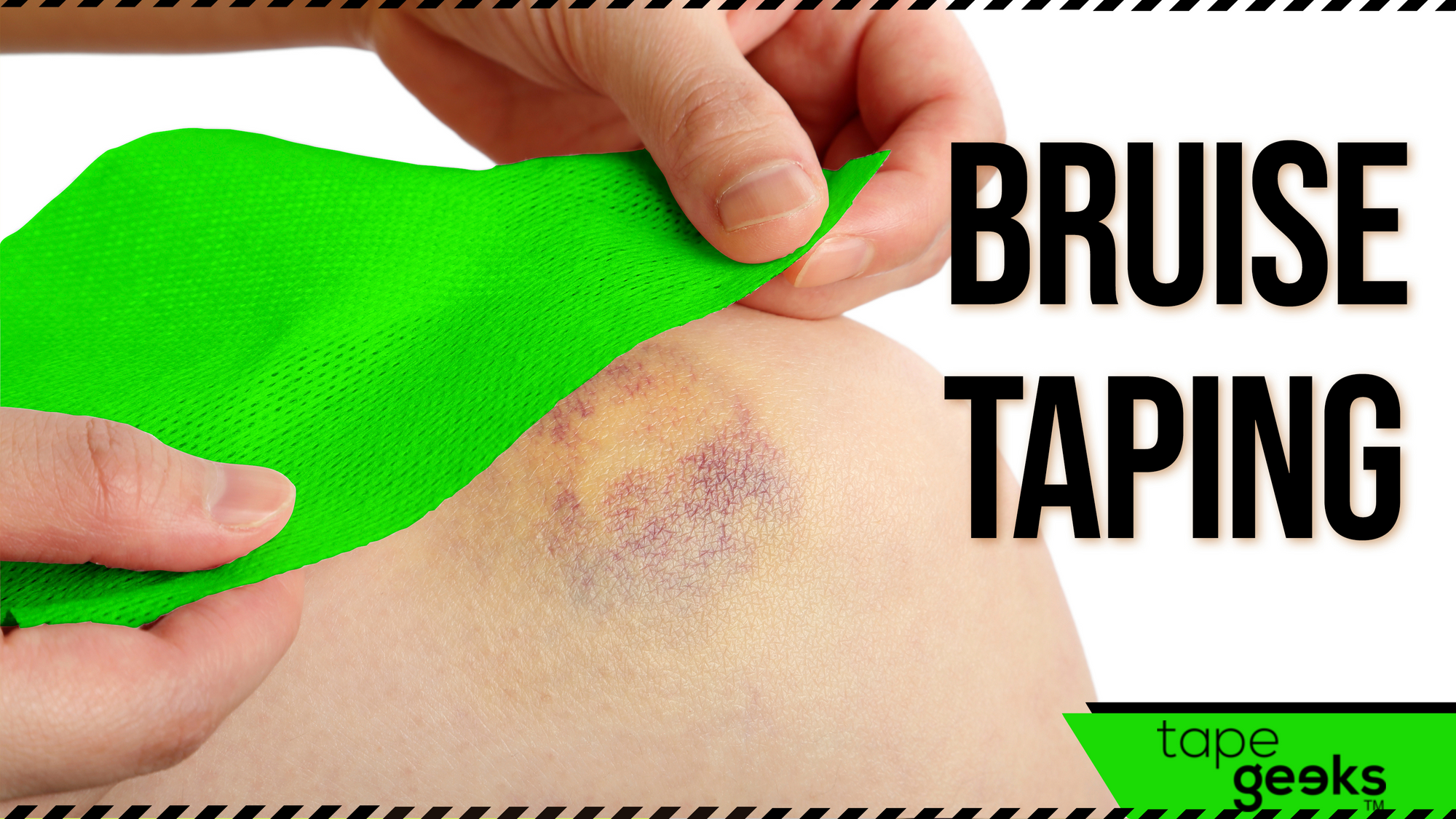 Bruise taping