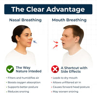 TG Nasal Strips